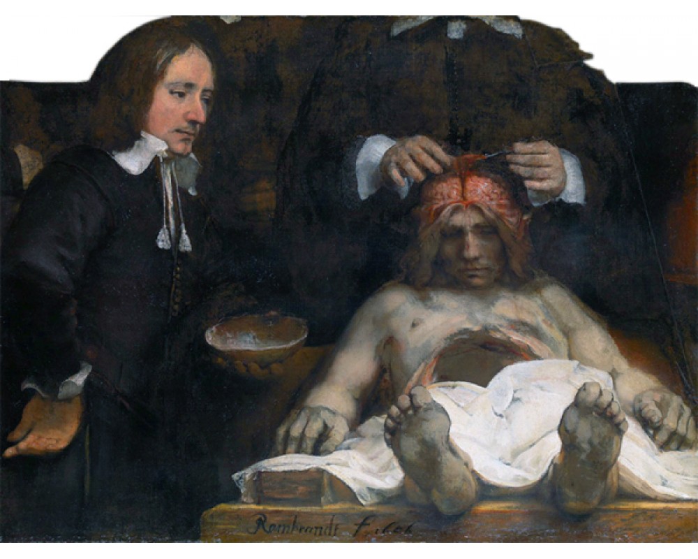 The Anatomy Lesson of Dr. Deijman